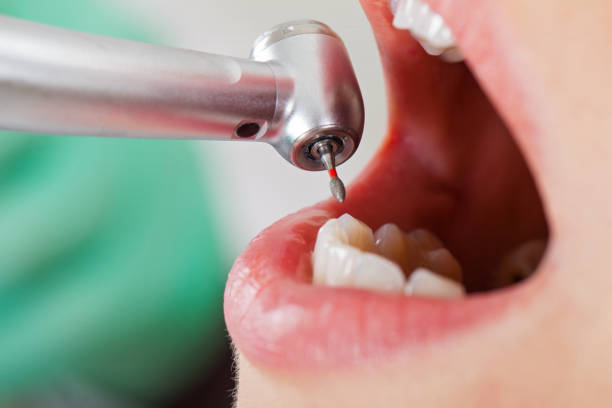 Best Emergency Treatment for Oral Infections in Willow Creek, CA